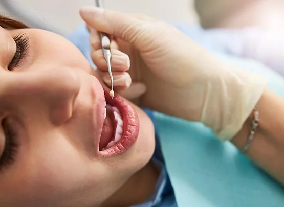 Dental Fillings